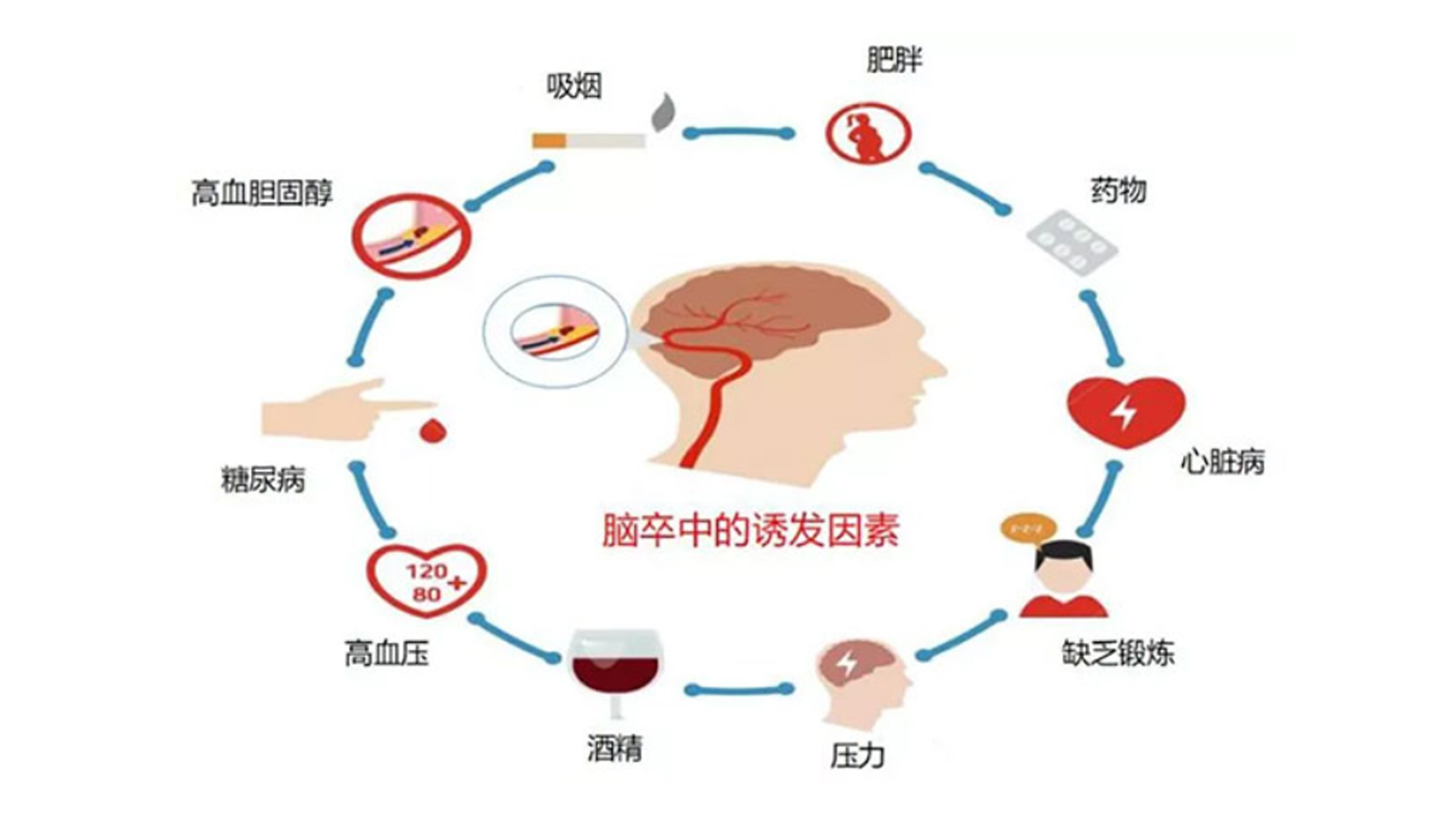 脑梗与深静脉血栓：不可忽视的血管危机