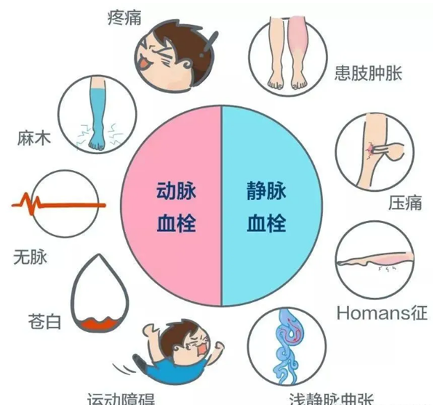 2022世界血栓日：就医有新路，血栓找介入