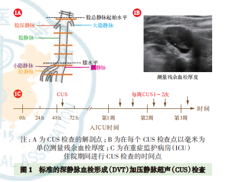 老年重症患者静脉血栓栓塞症预防中国专家共识（2023）