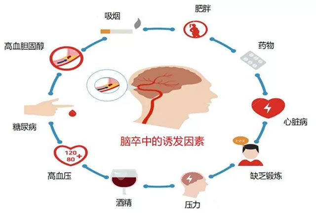 脑梗与深静脉血栓：不可忽视的血管危机